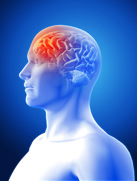 Beyin Tümörü Nedir? Belirtileri Nelerdir?