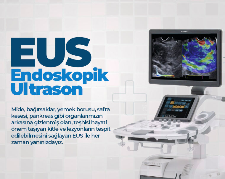 EUS Endoskopik Ultrason