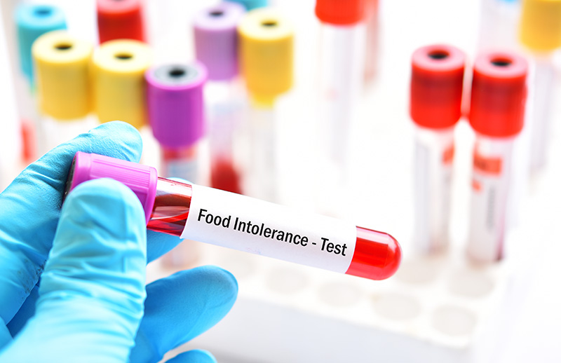 Besin İntolerans (Gıda Duyarlılık) Testi