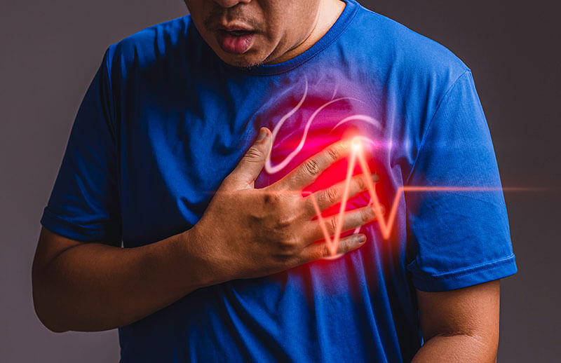 Kalp Krizi (Akut Miyokard İnfarktüsü)