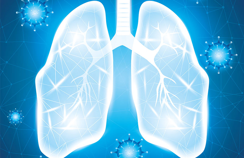 Pulmoner Emboli