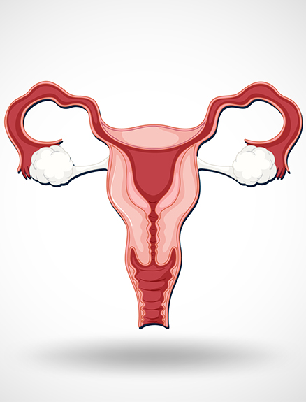 Rahim Kanseri (Uterus) Nedir?