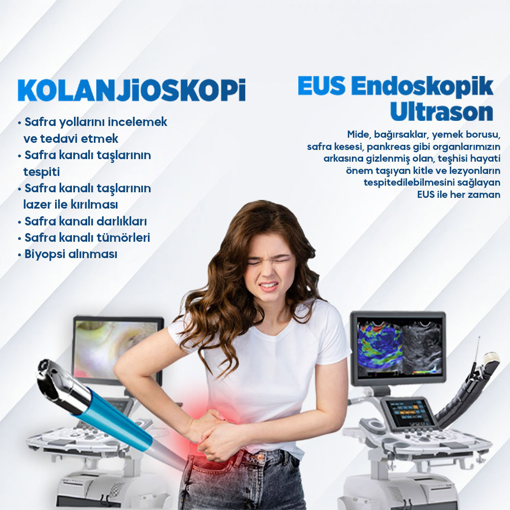 EUS Endoskopik Ultrason