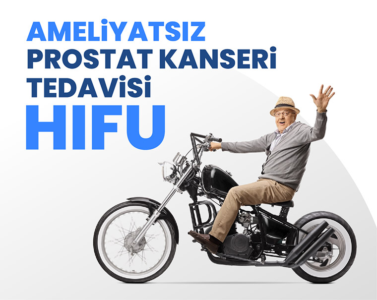 HIFU Aameliyatsız Prostat kanseri Tedavisi