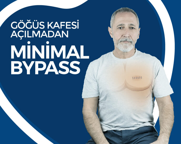 Göğüs Kafesi Açılmadan Minimal Bypass