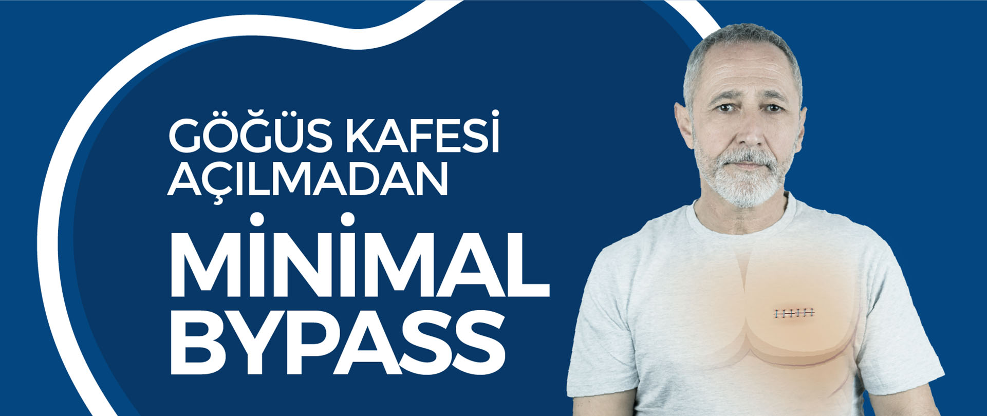 Göğüs Kafesi Açılmadan Minimal Bypass